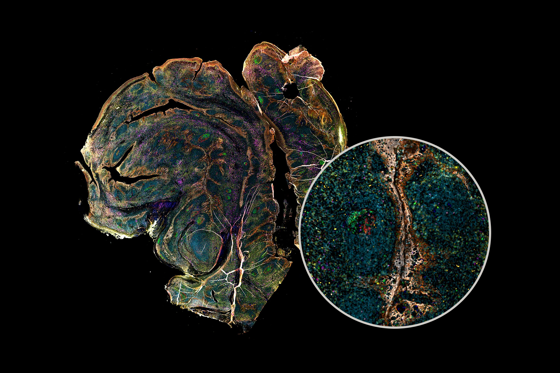 <p>Designed microscopy software in the complex field of spatial biology to ensure fast and easy operation without compromising scientific functionality.</p><p>Led the end-to-end process as UX responsible, from UX Planning, to User Research, Concept Creation and Software Development.</p>